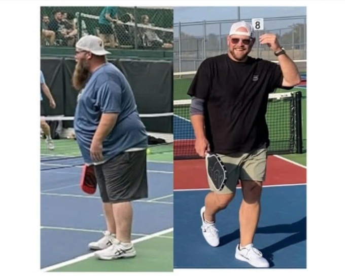 Vận động viên người Mỹ giảm hơn 90kg nhờ chơi pickleball - 2 Vận động viên người Mỹ giảm hơn 90kg nhờ chơi pickleball - 2